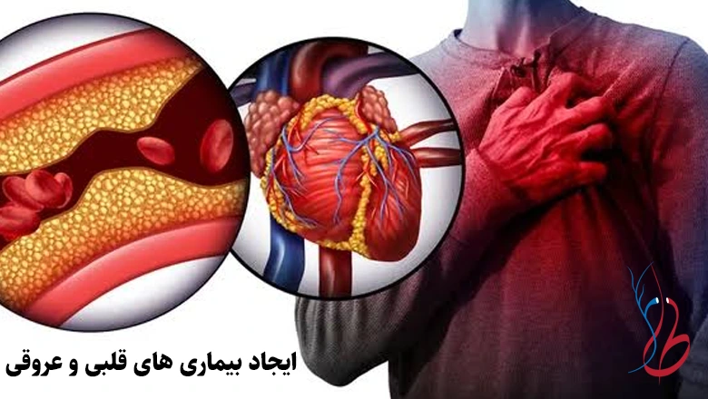 آیا واریس خطرناک است؟ خطرات بی توجهی به واریس 7 ایجاد بیماری های قلبی و عروقی