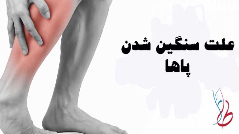 علت سنگینی پاها