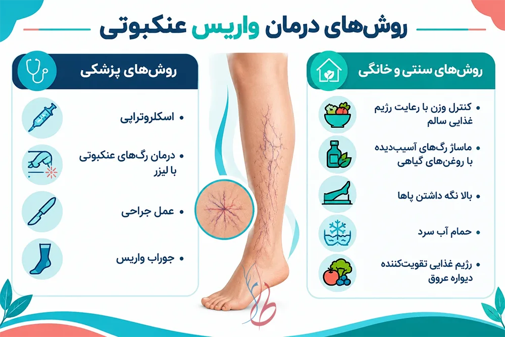واریس عنکبوتی چیست؟ عوارض و علت ایجاد تلانژکتازی پا 5 روشهای درمان واریس عنکبوتی