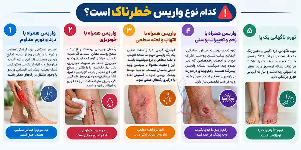 آیا واریس خطرناک است؟ خطرات بی توجهی به واریس 8 Which type of varicose veins is dangerous