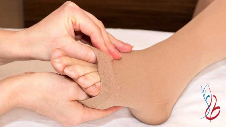 عوارض جوراب واریس چیست
