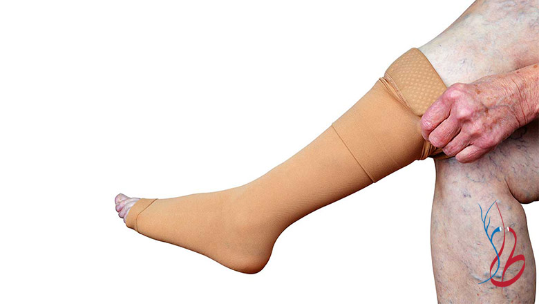 خوابیدن با جوراب واریس درست است؟ آیا جوراب واریس شب ضرر دارد 3 عملکرد دقیق جوراب های فشاری در سیستم گردش خون