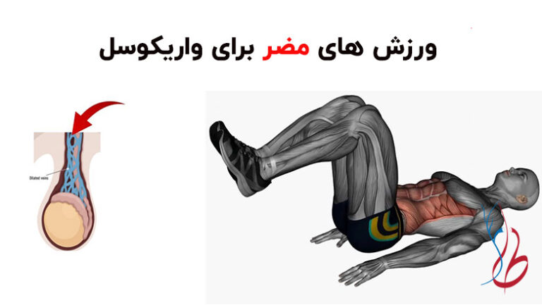 ورزش های مضر برای واریکوسل