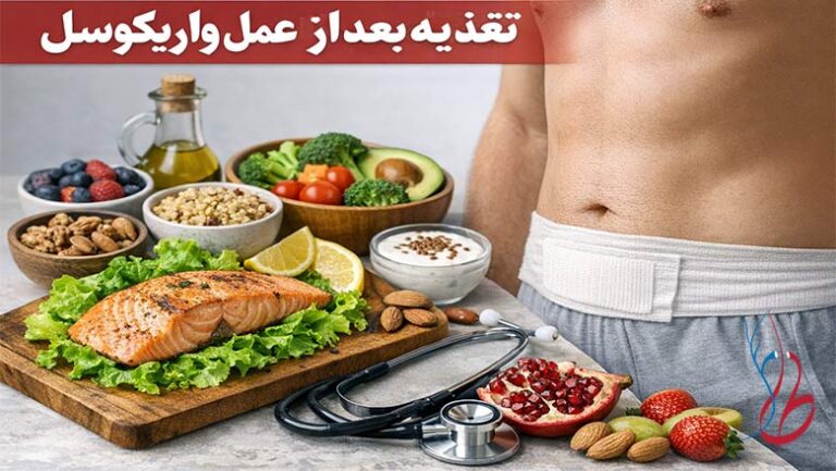 تغذیه بعد از عمل واریکوسل