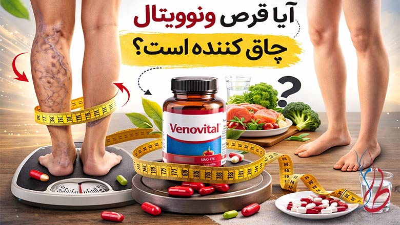 آیا قرص ونوویتال چاق کننده است و روی واریس پا تاثیری دارد؟ 8 قرص ونوویتال چاق کننده است