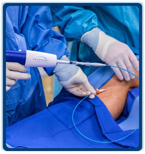 Varicose glue in clinic