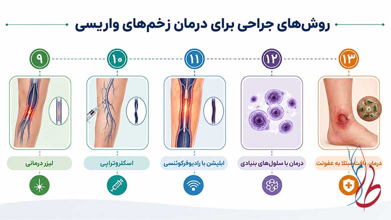 برای درمان زخم واریس پا چه کنیم؟ 13 راهکار سریع و موثر 4 روش های جراحی برای درمان زخم های واریسی