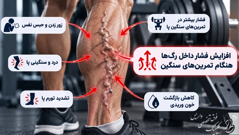 ورزش های مضر برای واریس؛ 8 اشتباه ورزشی که ممکن است پشیمانتان کند 3 چرا بعضی ورزشها برای واریس مناسب نیستند؟